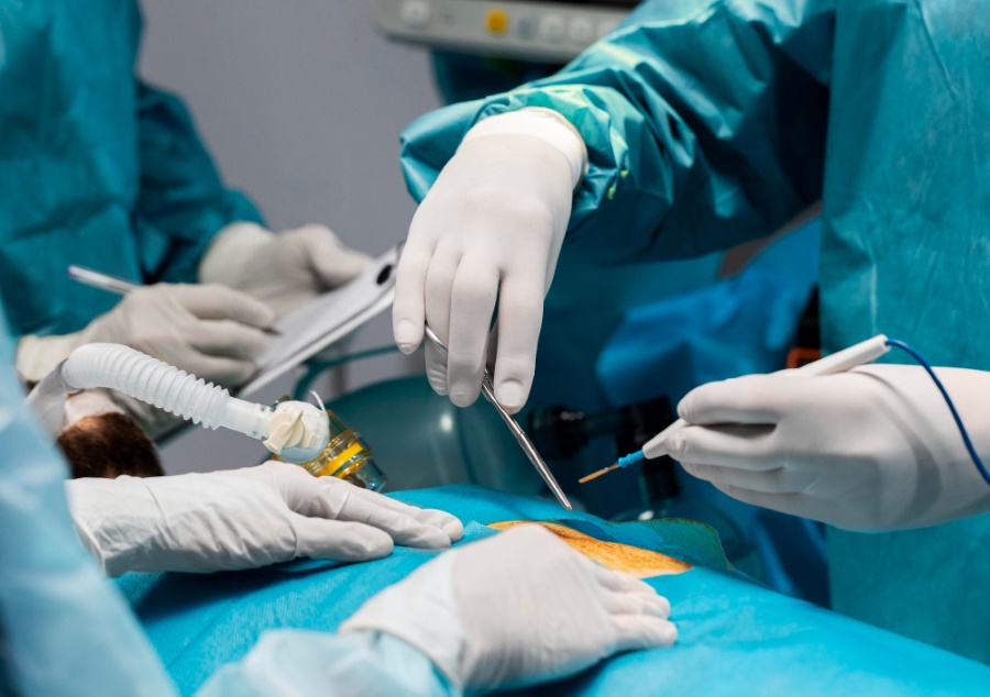 Role of Laparoscopic Instruments in Modern Surgery 1 Image Explains The Role of Laparoscopic Instruments in Modern Surgery